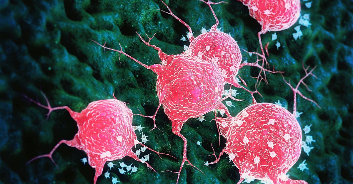 Expert Perspectives on Brain Metastasis Management A Conversation With Anna Berghoff, MD, PhD