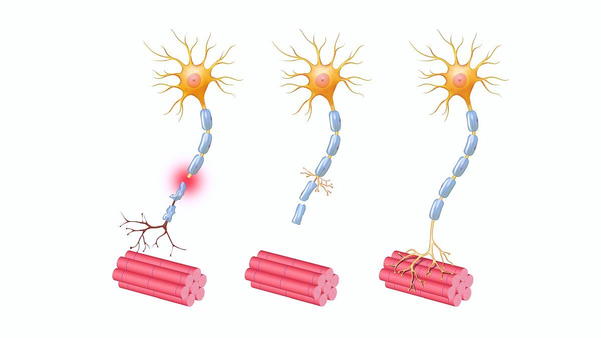 Guidelines for Chemotherapy-induced Peripheral Neuropathy Reflect a Continued Paucity of Evidence Aptitude Health Blog
