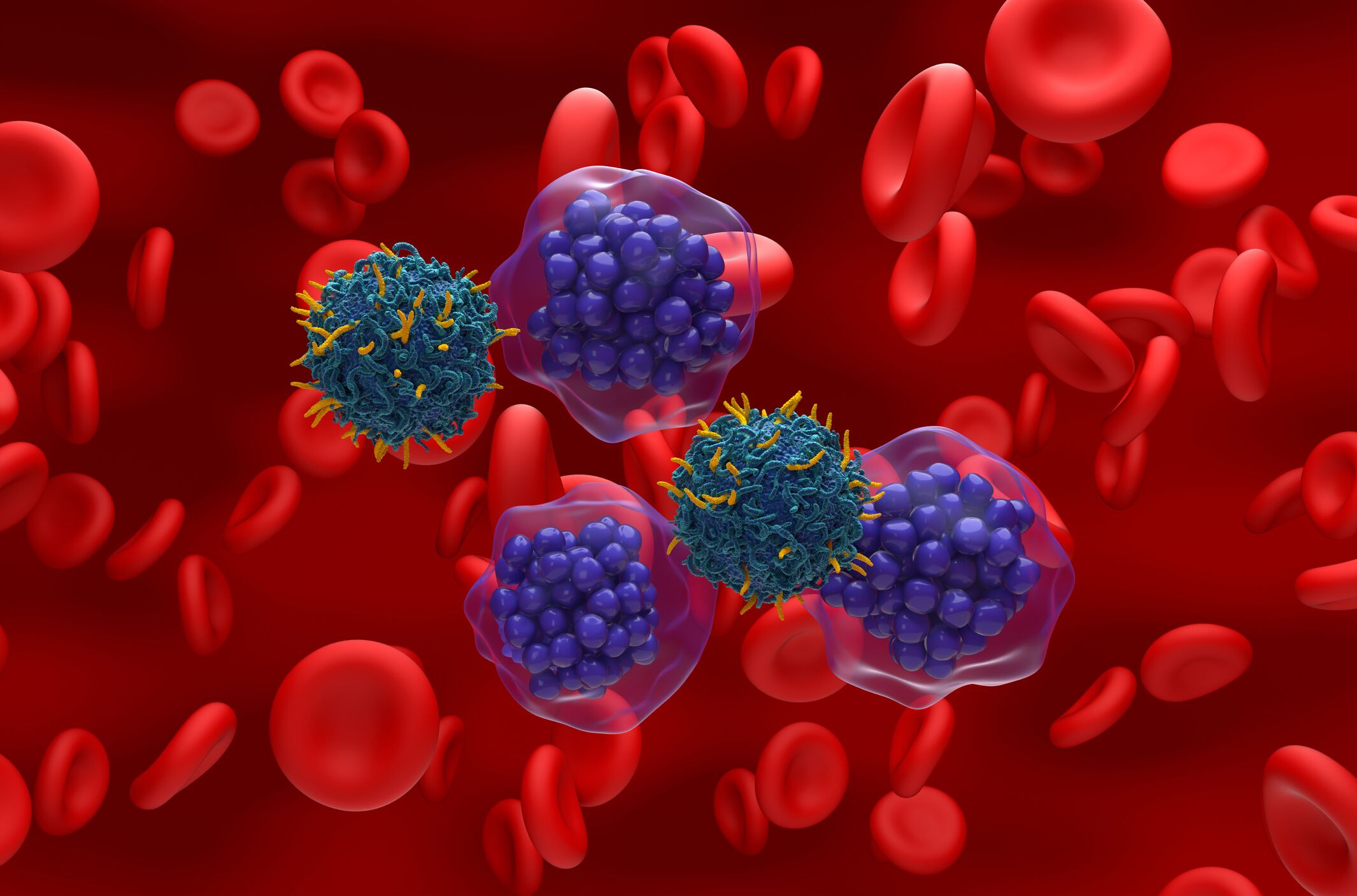 CAR-T cell therapy for diffuse large B-cell lymphoma, illustration